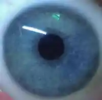 Iris